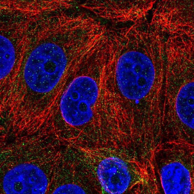 Atlas Antibodies Anti-C6orf47 Antibody