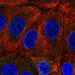 Atlas Antibodies Anti-C6orf47 Antibody