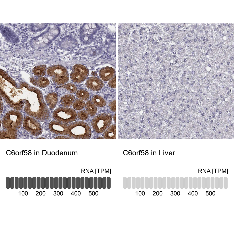 Atlas Antibodies Anti-C6orf58 Antibody