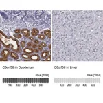 Atlas Antibodies Anti-C6orf58 Antibody