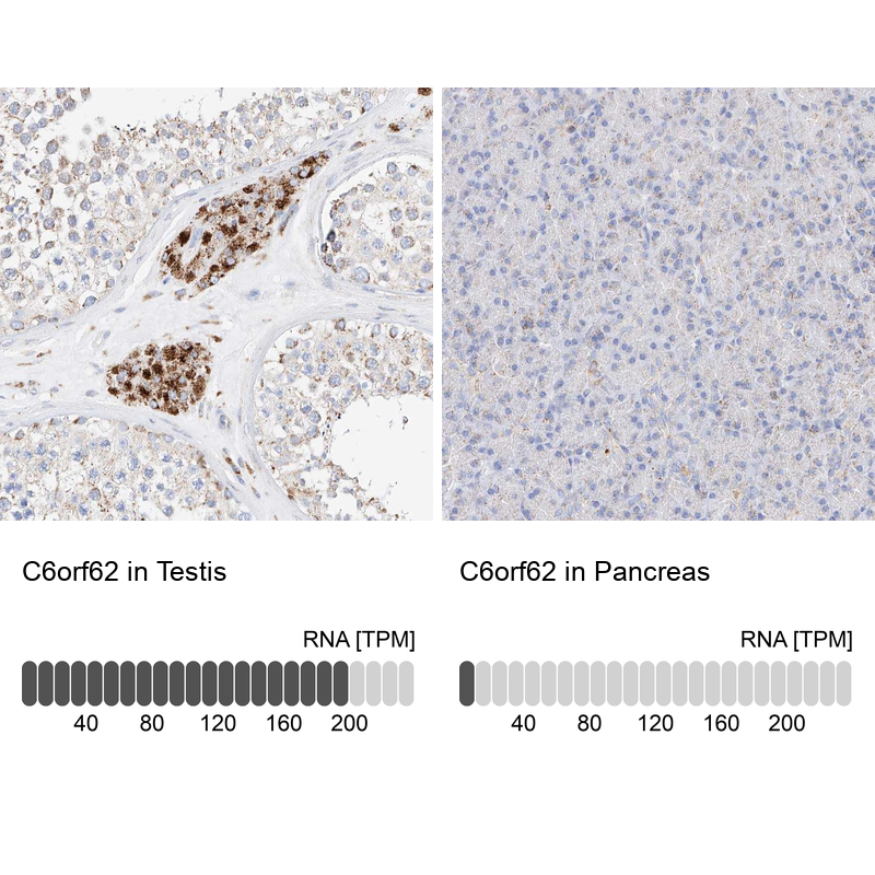 Atlas Antibodies Anti-C6orf62 Antibody