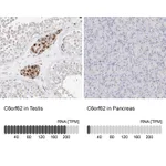 Atlas Antibodies Anti-C6orf62 Antibody