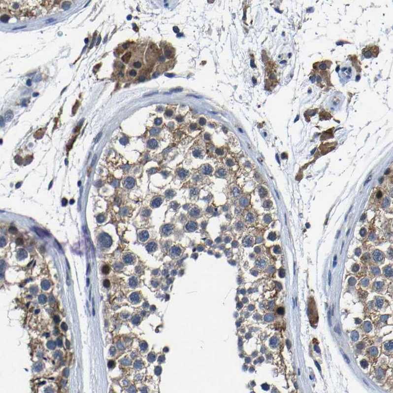 Atlas Antibodies Anti-C6orf89 Antibody
