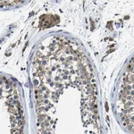Atlas Antibodies Anti-C6orf89 Antibody