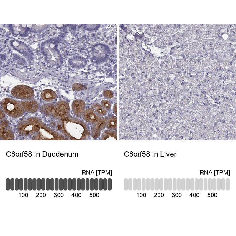 Atlas Antibodies Anti-C6orf58 Antibody