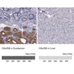 Atlas Antibodies Anti-C6orf58 Antibody