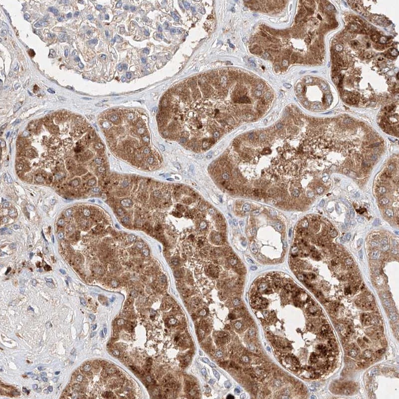 Atlas Antibodies Anti-C6orf62 Antibody