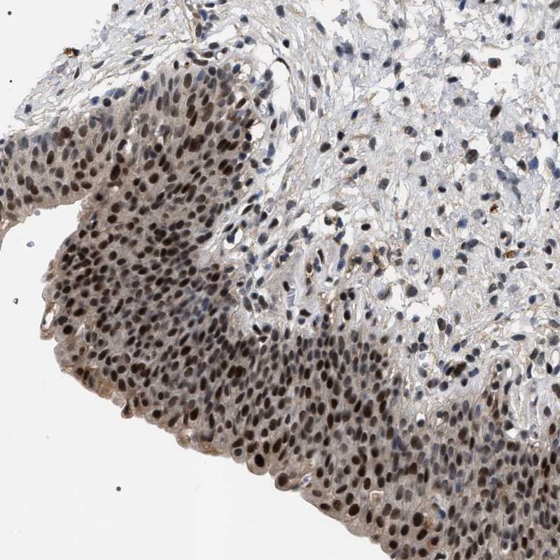 Atlas Antibodies Anti-C7orf25 Antibody