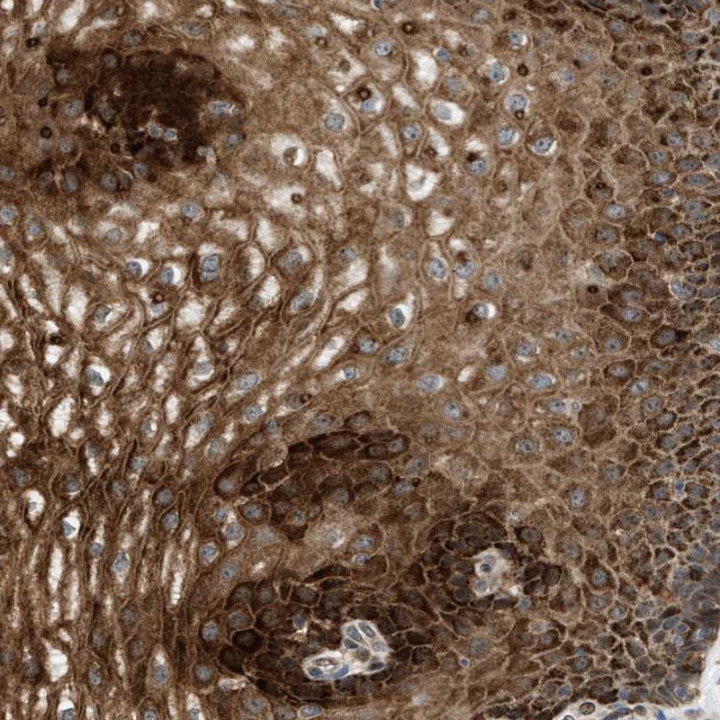 Atlas Antibodies Anti-C7orf43 Antibody