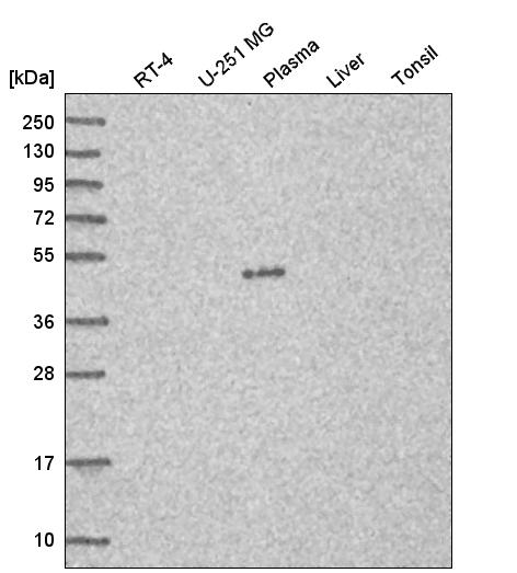 Atlas Antibodies Anti-C7orf25 Antibody