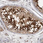 Atlas Antibodies Anti-C7orf43 Antibody