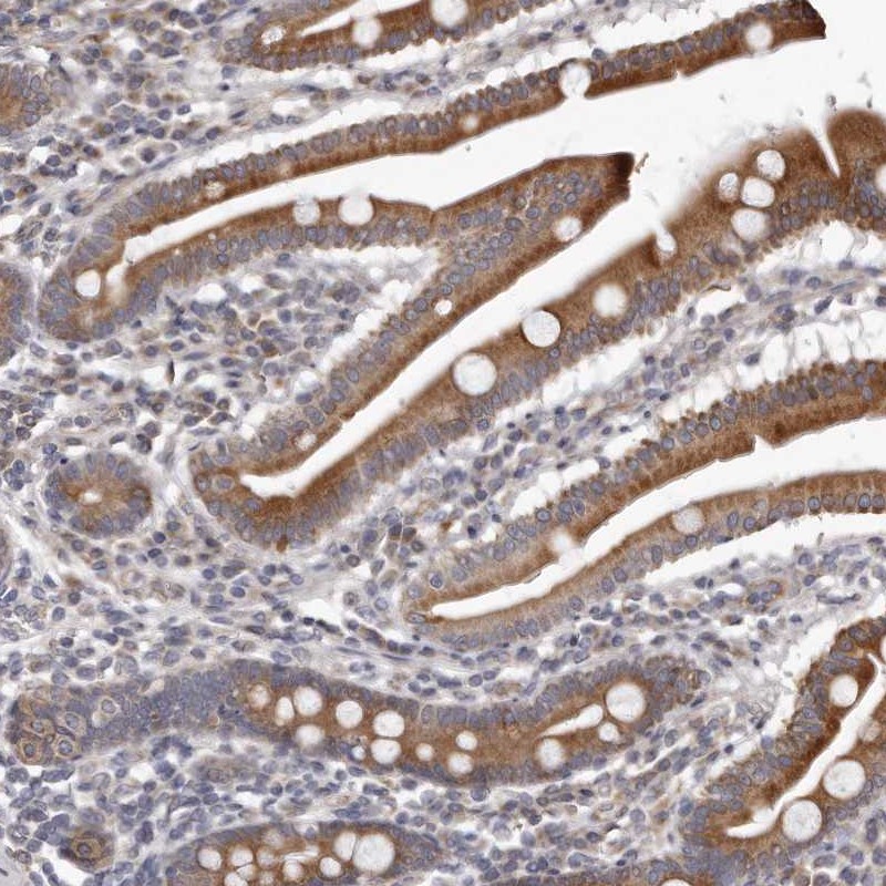 Atlas Antibodies Anti-C7orf43 Antibody