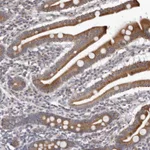 Atlas Antibodies Anti-C7orf43 Antibody