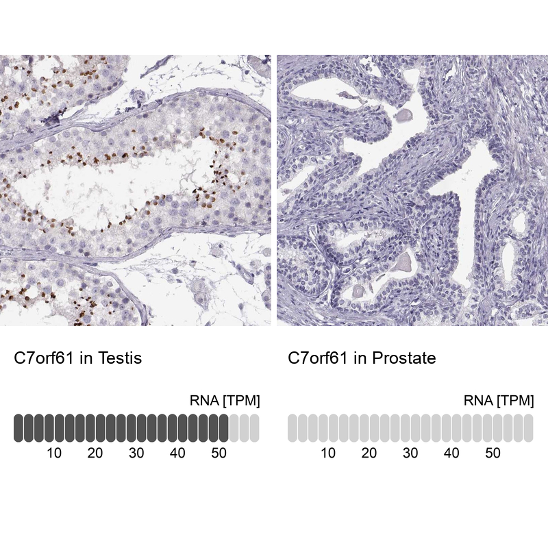 Atlas Antibodies Anti-C7orf61 Antibody