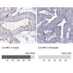 Atlas Antibodies Anti-C7orf61 Antibody
