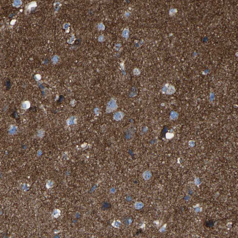 Atlas Antibodies Anti-C7orf49 Antibody