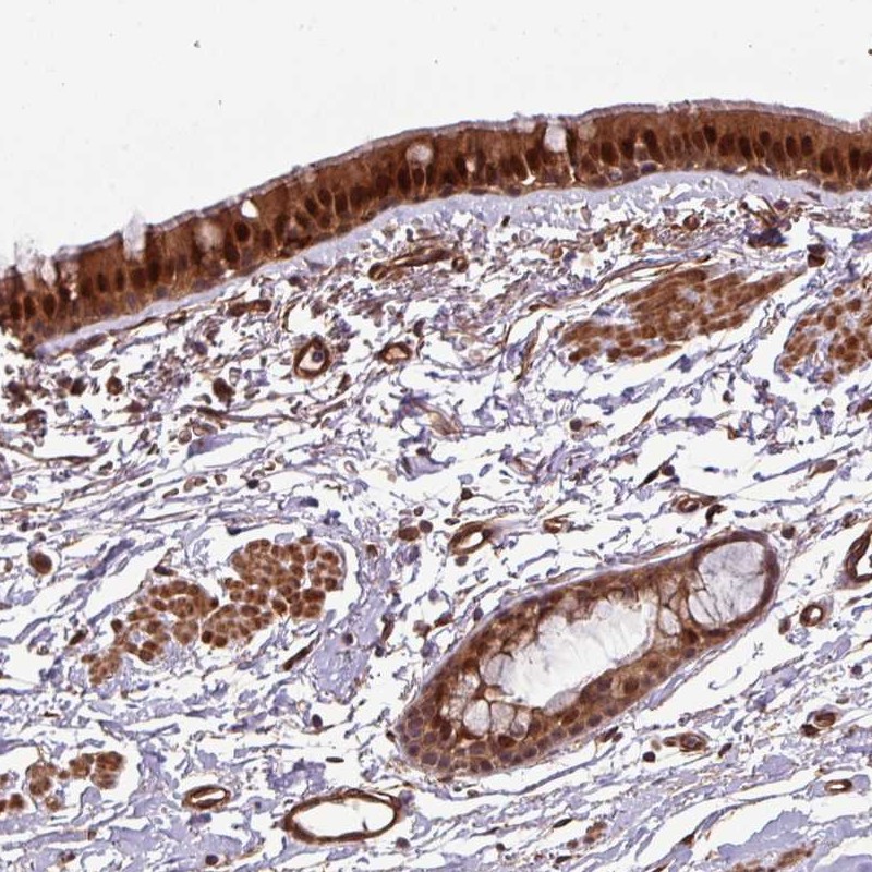 Atlas Antibodies Anti-C7orf50 Antibody