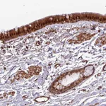 Atlas Antibodies Anti-C7orf50 Antibody