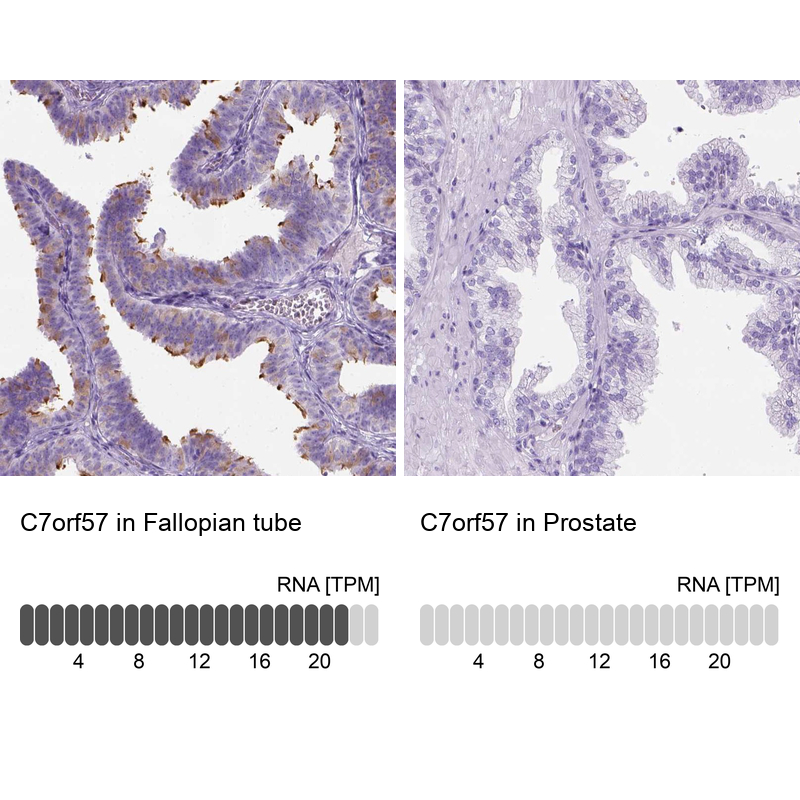 Atlas Antibodies Anti-C7orf57 Antibody