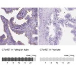 Atlas Antibodies Anti-C7orf57 Antibody