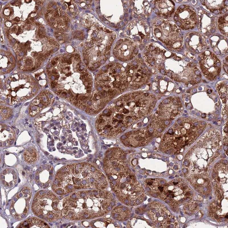 Atlas Antibodies Anti-C8G Antibody