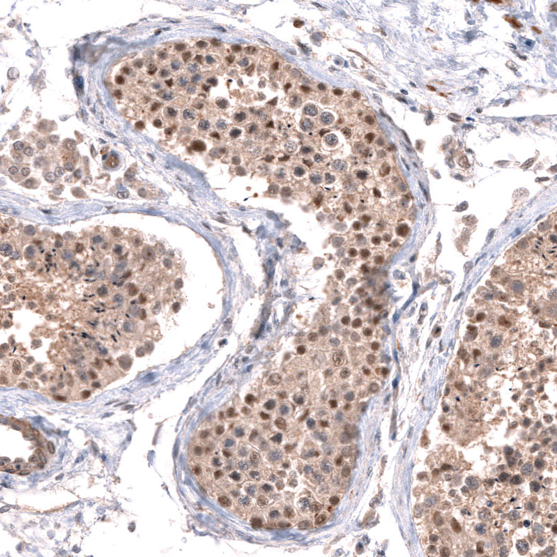 Atlas Antibodies Anti-C7orf72 Antibody