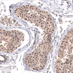 Atlas Antibodies Anti-C7orf72 Antibody
