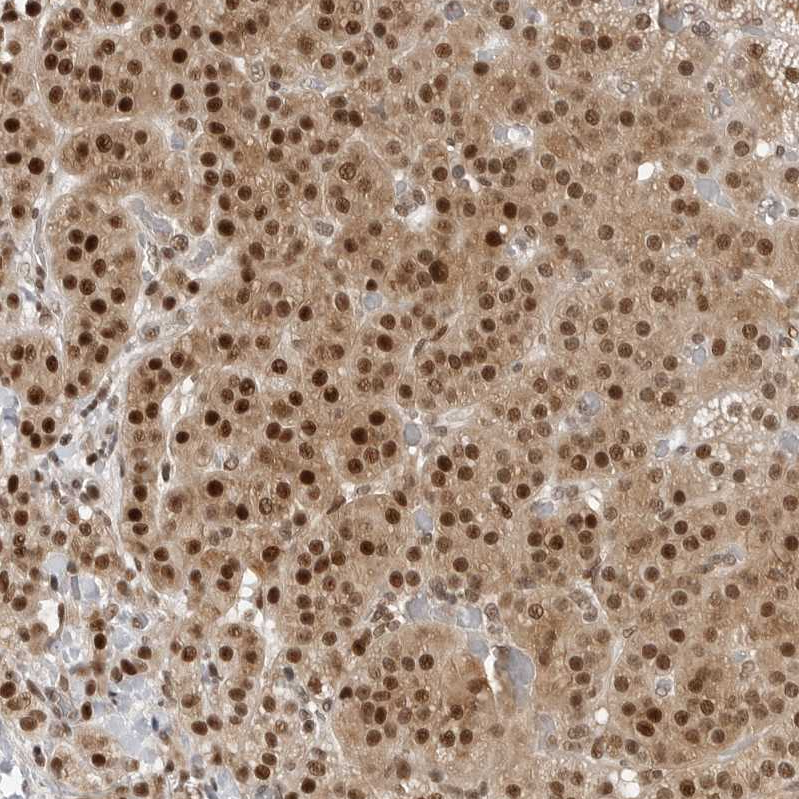 Atlas Antibodies Anti-C8orf33 Antibody