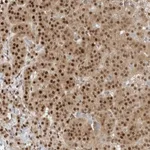 Atlas Antibodies Anti-C8orf33 Antibody