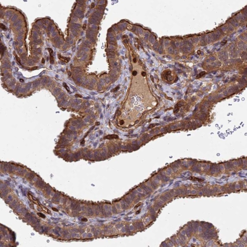Atlas Antibodies Anti-C8orf34 Antibody