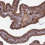 Atlas Antibodies Anti-C8orf34 Antibody