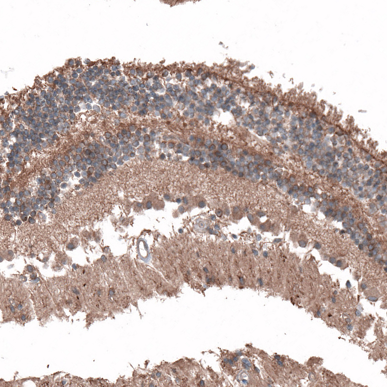 Atlas Antibodies Anti-C8orf37 Antibody