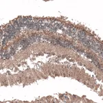 Atlas Antibodies Anti-C8orf37 Antibody