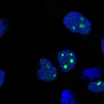 Atlas Antibodies Anti-C8orf34 Antibody