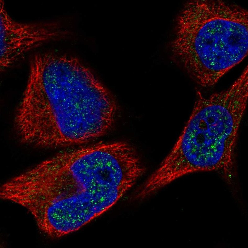 Atlas Antibodies Anti-C8orf46 Antibody