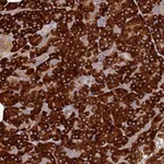 Atlas Antibodies Anti-C8orf44 Antibody