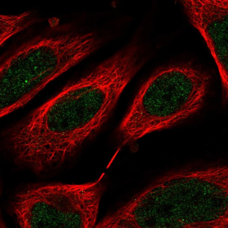 Atlas Antibodies Anti-C8orf44 Antibody