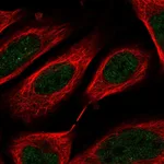 Atlas Antibodies Anti-C8orf44 Antibody