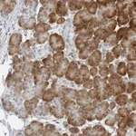 Atlas Antibodies Anti-C8orf48 Antibody