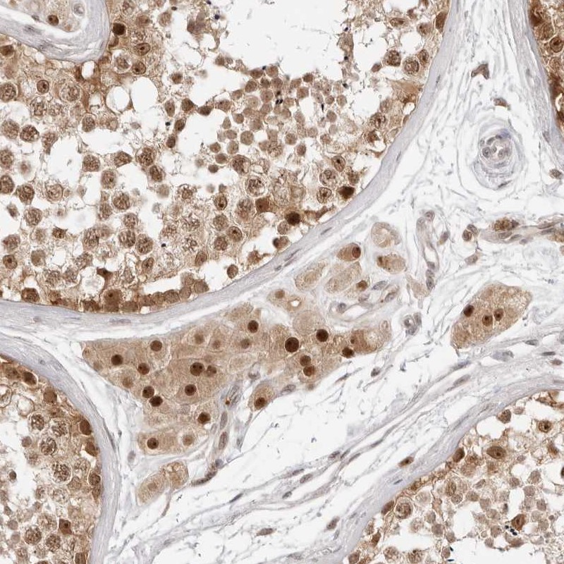 Atlas Antibodies Anti-C8orf48 Antibody