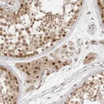 Atlas Antibodies Anti-C8orf48 Antibody