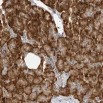 Atlas Antibodies Anti-C8orf48 Antibody