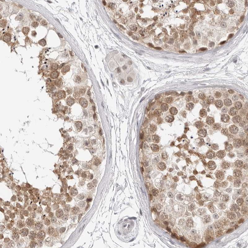 Atlas Antibodies Anti-C8orf48 Antibody