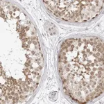 Atlas Antibodies Anti-C8orf48 Antibody