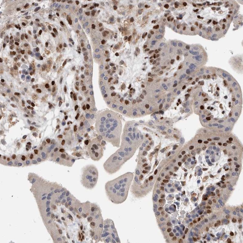 Atlas Antibodies Anti-C8orf58 Antibody