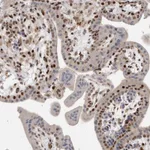 Atlas Antibodies Anti-C8orf58 Antibody
