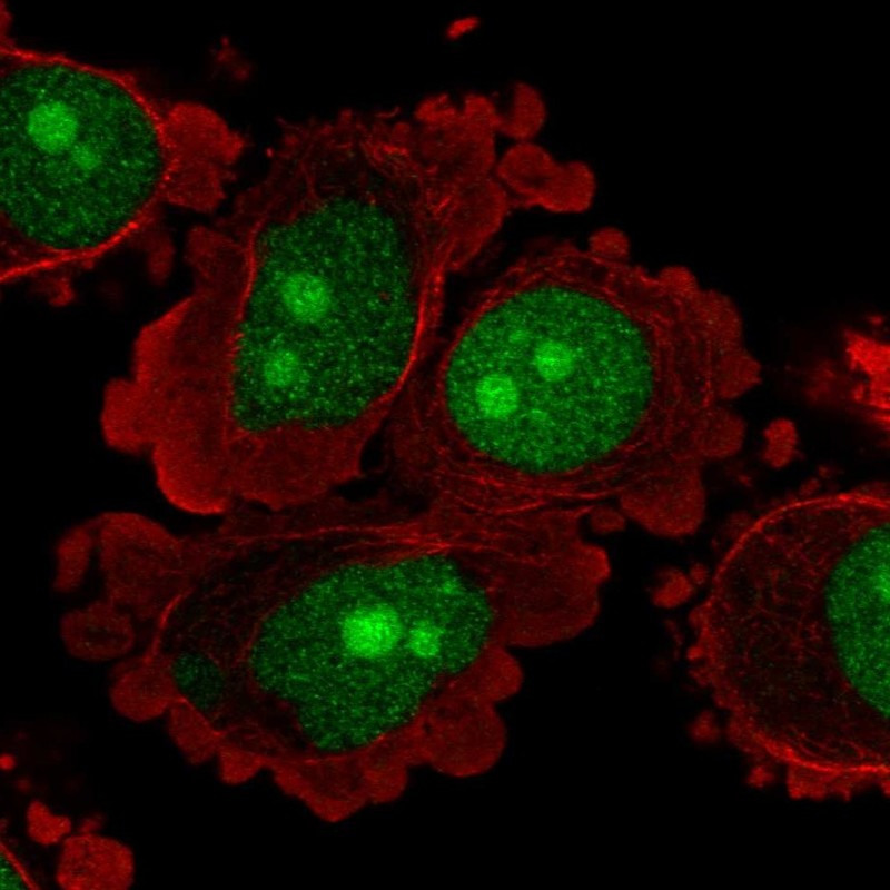 Atlas Antibodies Anti-C8orf59 Antibody