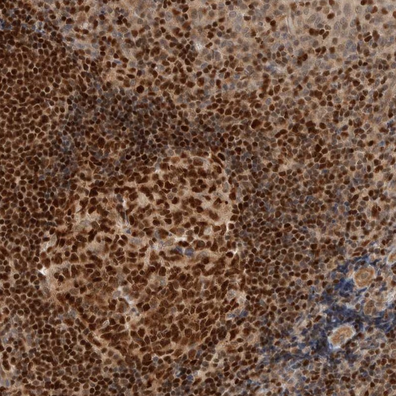 Atlas Antibodies Anti-C8orf76 Antibody
