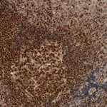 Atlas Antibodies Anti-C8orf76 Antibody