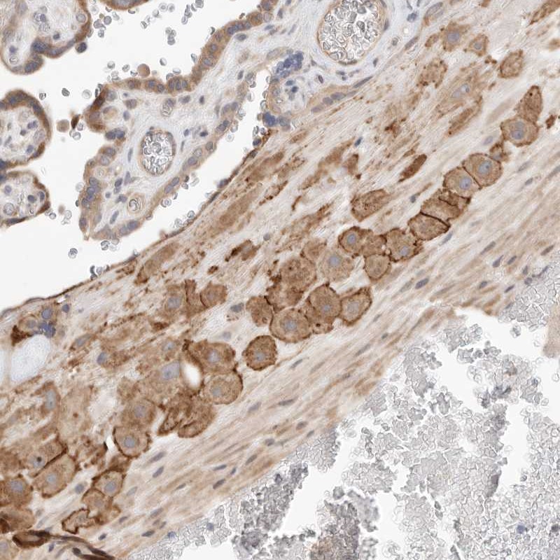 Atlas Antibodies Anti-C8orf86 Antibody
